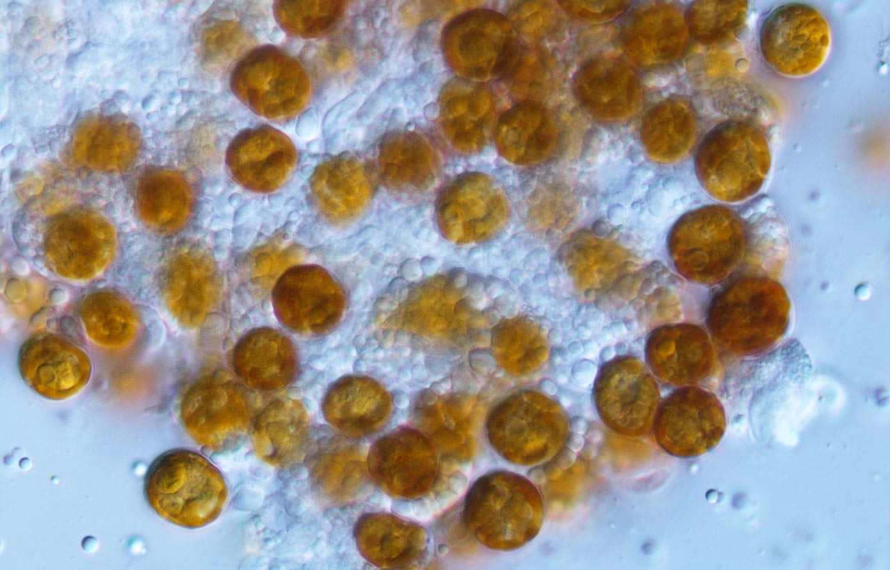 Scientists Resurrect “Forgotten” Genus of Symbiotic Algae Living in